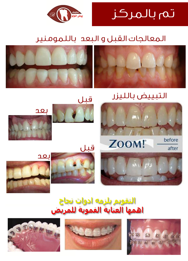 دليلك في الطائف مستوصف بياض اللؤلؤ للاسنان